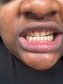 Perfect Smile Experience