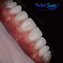 Perfect Smile Experience