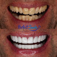 Perfect Smile Experience