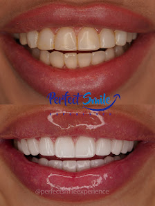 Perfect Smile Experience