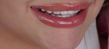 Perfect Smile Experience