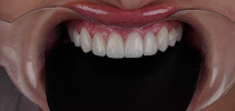 Perfect Smile Experience