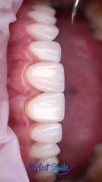 Perfect Smile Experience