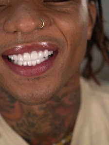 Perfect Smile Experience