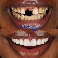 Perfect Smile Experience