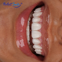 Perfect Smile Experience