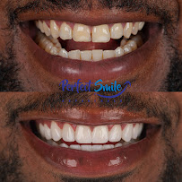Perfect Smile Experience