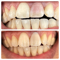 Seven Smile Klinik
