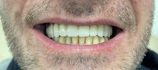Seven Smile Klinik