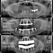 Dent Sur Ağız ve Diş Sağlığı, Çocuk Diş Hekimi, Ortodonti, Kanal tedavisi, İmplant, Gülüş Tasarımı, Zirkonyum, Tomografi(3D)