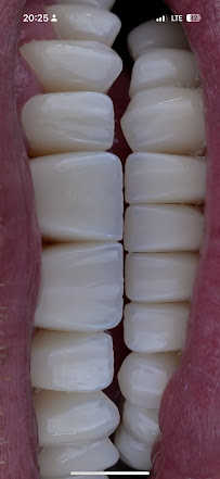 Dent Sur Ağız ve Diş Sağlığı, Çocuk Diş Hekimi, Ortodonti, Kanal tedavisi, İmplant, Gülüş Tasarımı, Zirkonyum, Tomografi(3D)