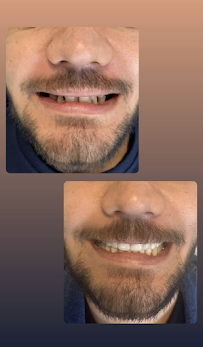 Diş Hekimi Hasan Akdoğan - Antalya Diş Hekimi - Antalya Dentist