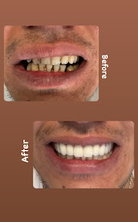 Diş Hekimi Hasan Akdoğan - Antalya Diş Hekimi - Antalya Dentist