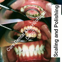 CARE DENTAL AND MAXILLOFACIAL CLINIC