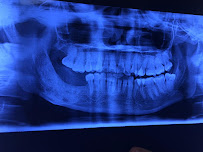 Dr. Arun Setia Dental Clinic- Maxillofacial Surgeon in Delhi, Oral Surgeon, Mouth Ulcer Specialist, Best Dental Surgeon Delhi
