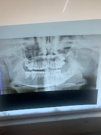 Dr. Arun Setia Dental Clinic- Maxillofacial Surgeon in Delhi, Oral Surgeon, Mouth Ulcer Specialist, Best Dental Surgeon Delhi