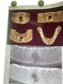 Dr. Arun Setia Dental Clinic- Maxillofacial Surgeon in Delhi, Oral Surgeon, Mouth Ulcer Specialist, Best Dental Surgeon Delhi
