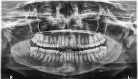 Your Oral Surgeon : Dr. Mohitt Mangla & Dr. Seema Aggarwal's Oral Surgery , Dental Implant & Dental Clinic -Yamuna Vihar