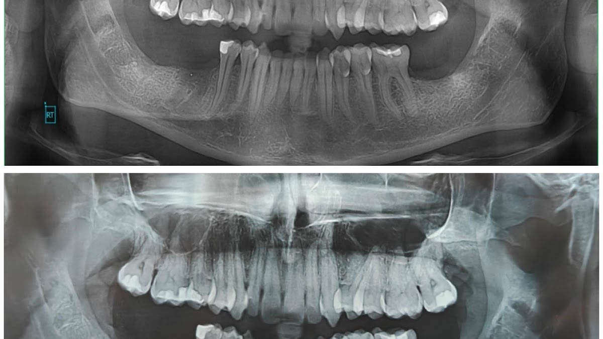 Dr Rohit Yadav Advanced Dental And Facial Centre dental clinic