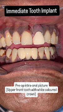 DR ROHIT YADAV IMPLANT SURGEON FACIAL TRAUMA SURGEON DWARKA