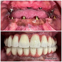 DR ROHIT YADAV IMPLANT SURGEON FACIAL TRAUMA SURGEON DWARKA