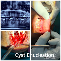 DR ROHIT YADAV IMPLANT SURGEON FACIAL TRAUMA SURGEON DWARKA