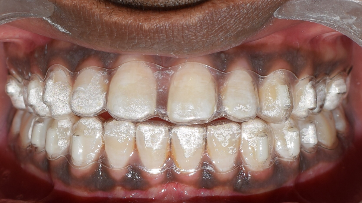 Mangla & Aggarwal Dental Clinic dental clinic