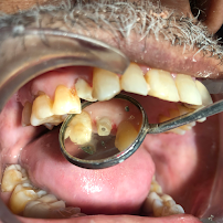 Your Oral Surgeon : Dr. Mohit Mangla || Dr. Seema Aggarwal || Dental Clinic & Implant Centre