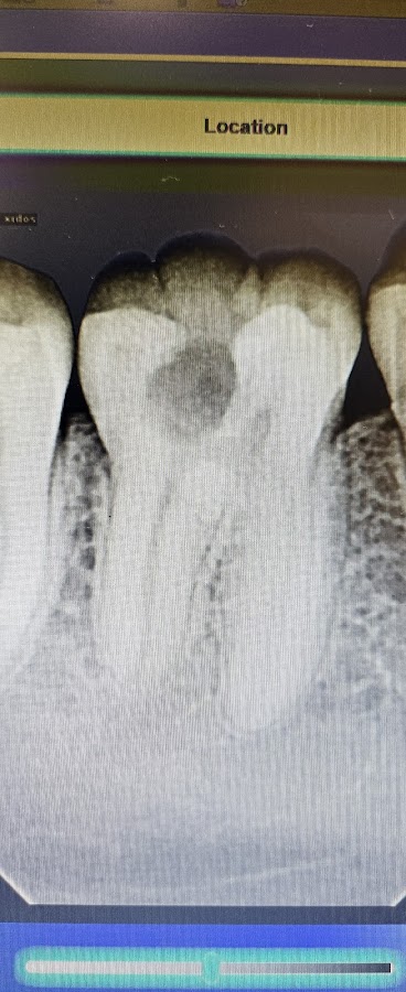 Dr. Mohit Mangla Oral & Maxillofacial Surgeon dental clinic