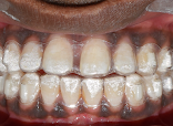Dr Mohit Mangla - Oral & Maxillofacial Surgeon