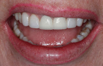 Bocas&Risas - Clínica Odontológica en Medellín