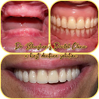 DR. BHUSHAN DENTAL ( best dentist in chattarpur Delhi , awarded as best dental clinic for RCT & Dental IMPLANT )