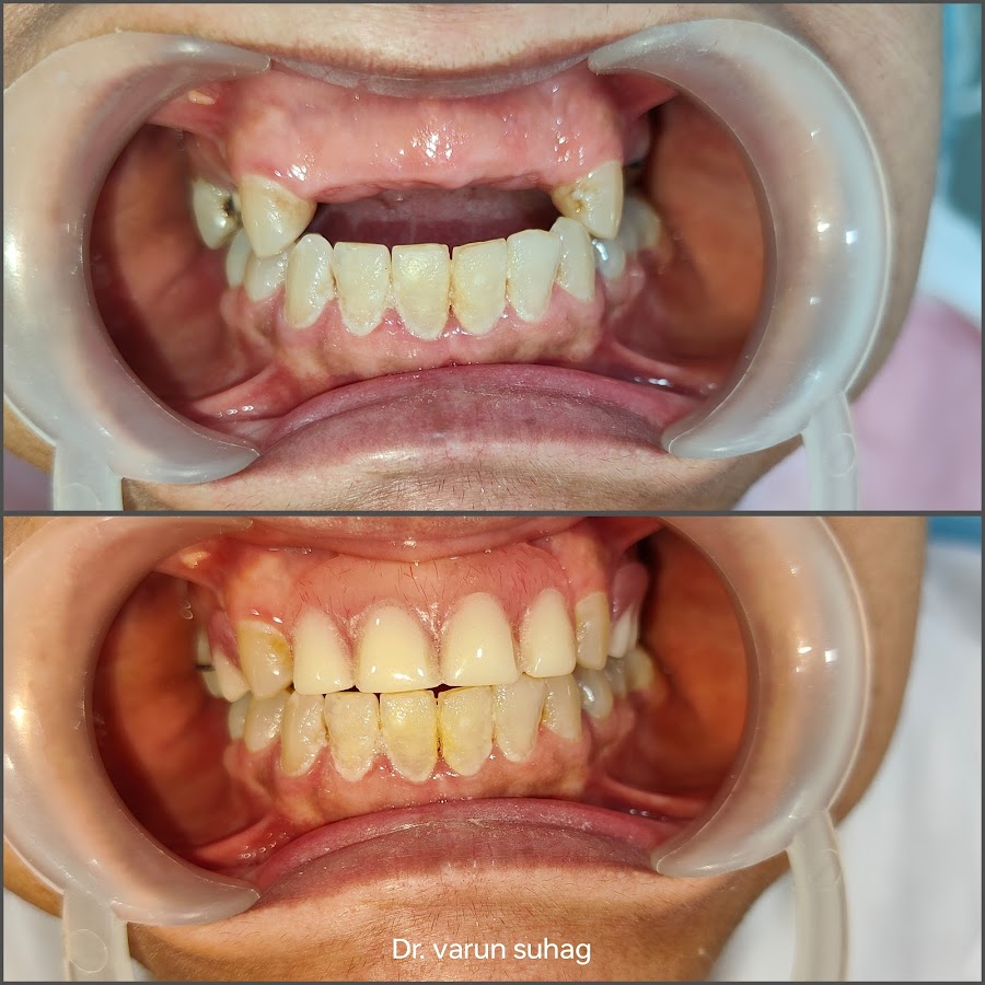 Dr. Varun Suhag dental clinic