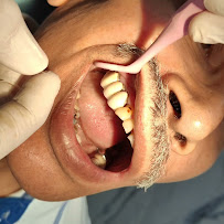 Dr. Varun Suhag- periodontist & oral implantologist in Delhi
