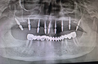 COSMO FULL MOUTH IMPLANT & MAXILLOFACIAL Surgery CENTER