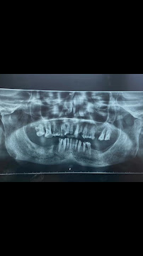 Pearl White Dental Clinic (On Cghs Panel) Multispeciality &Implant centre