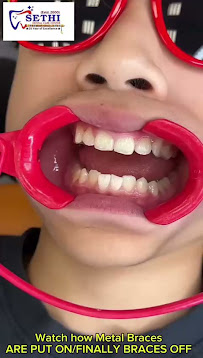 Sethi Dental care and implant Center -Dental clinic near me | best Dentist in Kalkaji & CR Park Delhi