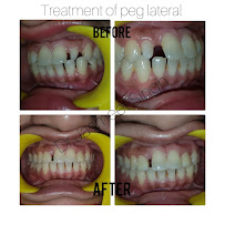 Noble Dental Care - Implant and Orthodontic Centre