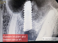 Noble Dental Care - Implant and Orthodontic Centre