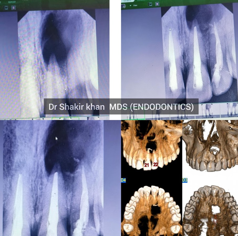 Dental Care And RCT Centre dental clinic in New Delhi