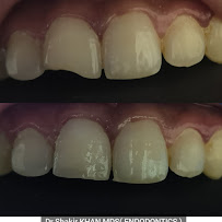 Ghaziabad Dental Care & RCT Speciality Center