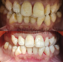 Ghaziabad Dental Care & RCT Speciality Center