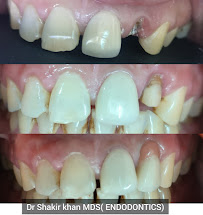 Ghaziabad Dental Care & RCT Speciality Center
