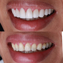 Now Dental Group