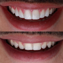 Now Dental Group