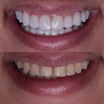 Now Dental Group