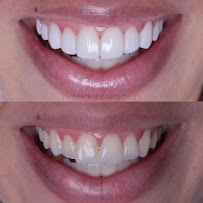 Now Dental Group