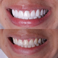 Now Dental Group