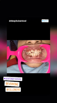 Dentoway Dental Clinic Vasant Kunj New Delhi