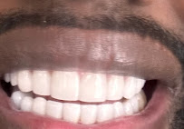 Smile Dental Center Medellín | Carillas Dentales y Diseño de Sonrisa